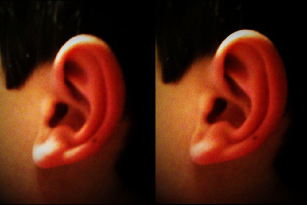 ear-lots2_l